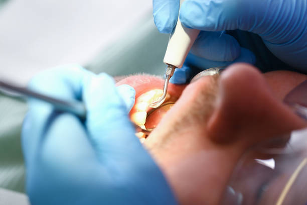 Best Emergency Treatment for Toothache in Westlake Corner, VA